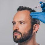 Spritzentherapie gegen Haarausfall – die individuelle Behandlung
