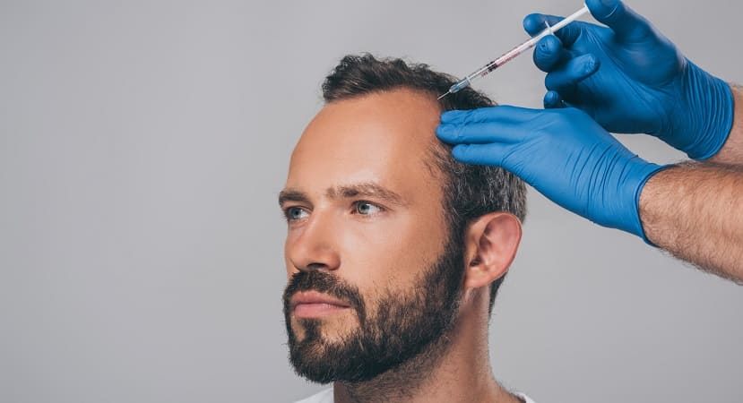 Spritzentherapie gegen Haarausfall – die individuelle Behandlung