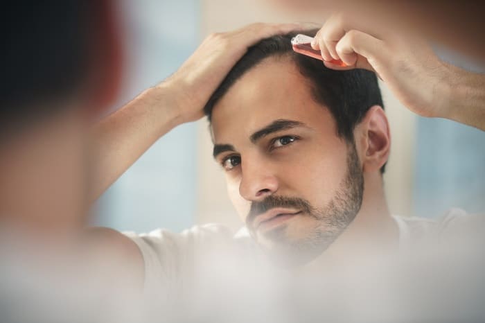 Tipps gegen Haarausfall bei Männer