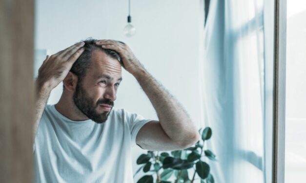 Minoxidil bei Geheimratsecken